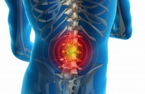 Безоперационное лечение межпозвонковой грыжи: несколько методик